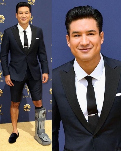 Mario Lopez in Medical Walking Boot